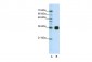 HNRPA0 antibody - middle region